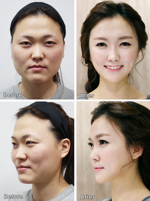 plastic-surgery-korea3.jpg