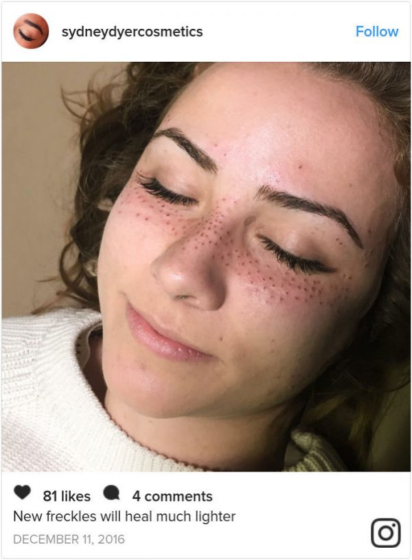 Freckle Face Tattoos Are Apparently a Beauty Trend Now