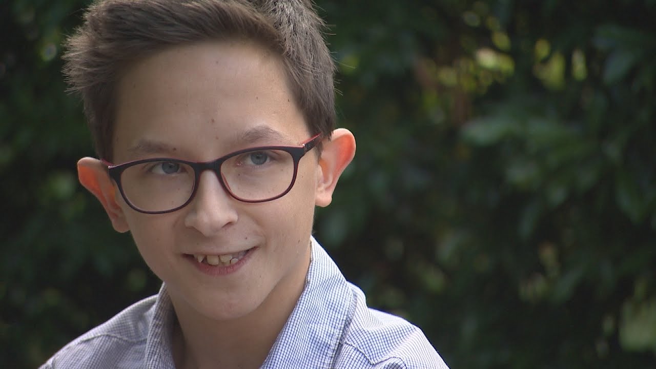 23YearOld Man Stuck in the Body of a 13YearOld Boy Due to Rare