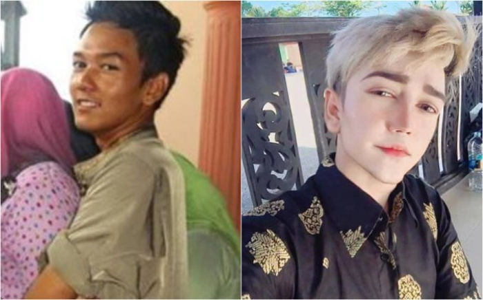 Malaysian Man Faces Criticism For Using Plastic Surgery To Look