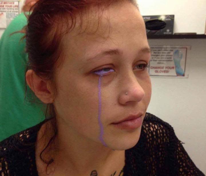 Ottawa woman who got botched eyeball tattoo: 'I'd rather get my eye taken  out' - National | Globalnews.ca