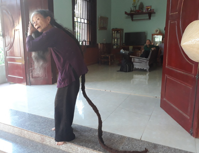 Vietnamese Woman Has 3-Meter Hair Snake Growing Out of Her Scalp