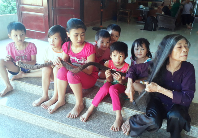 Vietnamese Woman Has 3-Meter Hair Snake Growing Out of Her Scalp