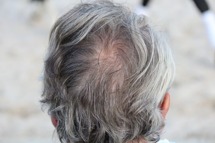 Japanese Business Specializes in Plucking Customers' White Hairs Japanese Business Specializes in Plucking Customers' White Hairs