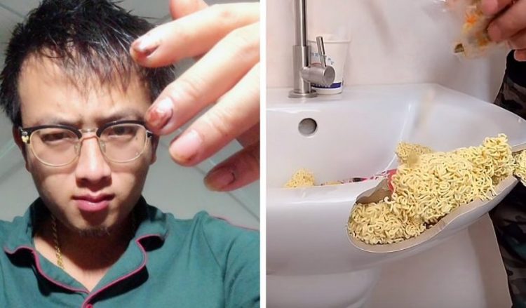 English engineer performs surgery on himself after being put on waiting list. Oddity Central . DIY | Oddity Central - Collecting Oddities