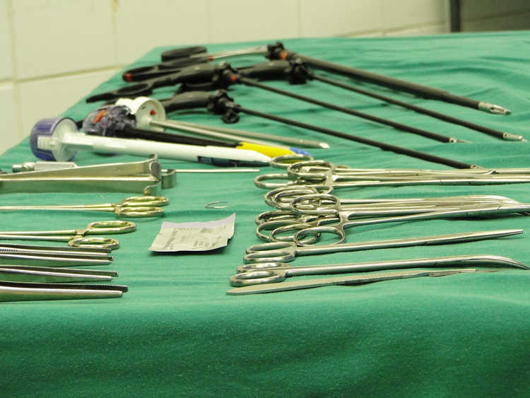 woman-had-surgical-clamp-lodged-in-her-abdomen-for-23-years