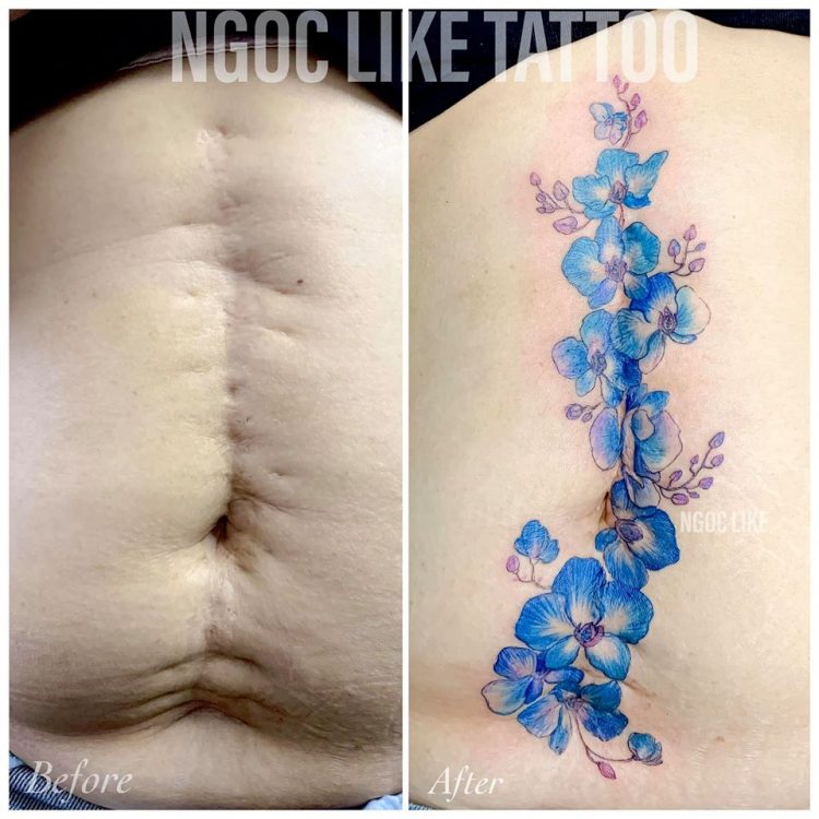 Vietnamese Tattoo Artist Masks People's Scars With Beautiful Artworks