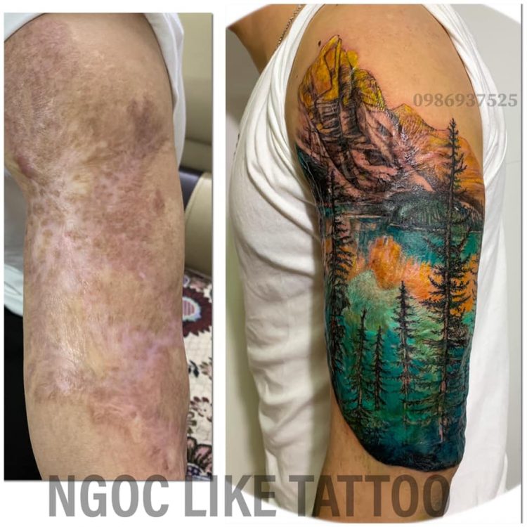 Vietnamese Tattoo Artist Masks People's Scars With Beautiful Artworks