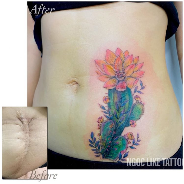 Vietnamese Tattoo Artist Masks People's Scars With Beautiful Artworks