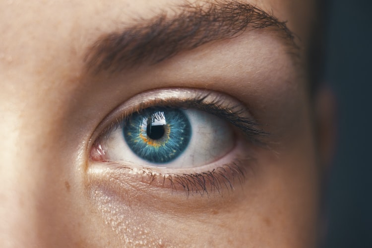 Haemolacria (Bloody Tears) - Anaheim Eye Institute