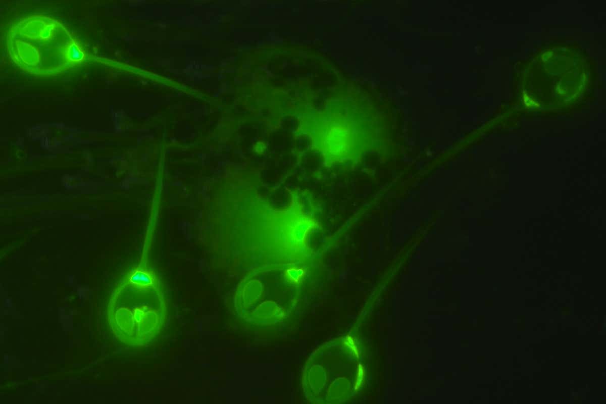 This Weird Parasite Is The Only Known Animal That Can Survive Without