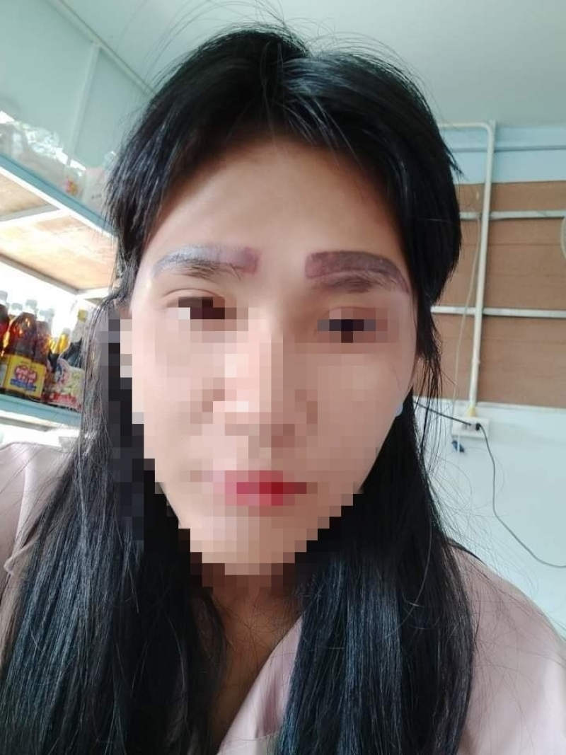 Woman Left With Double Eyebrows After Botched Tattoo Job