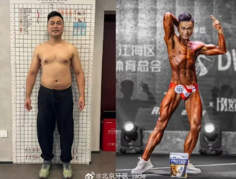 Doctor Loses 55 Pounds in 42 Days, Wins Bodybuilding Contest